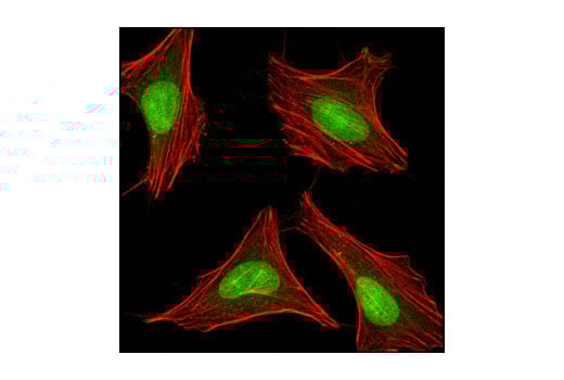 Immunofluorescence Image 1: PP2A A Subunit (81G5) Rabbit Monoclonal Antibody