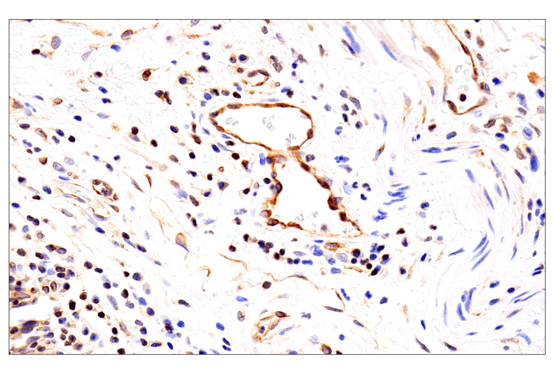 Immunohistochemistry Image 11: HLA-E (MEM-E/02) Mouse Monoclonal Antibody