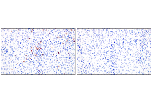 Immunohistochemistry Image 8: TRDC/TCR delta (E2E9T) Rabbit Monoclonal Antibody
