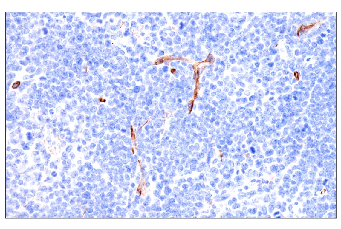 Immunohistochemistry Image 7: Nestin (E5C7I) Rabbit Monoclonal Antibody (BSA and Azide Free)