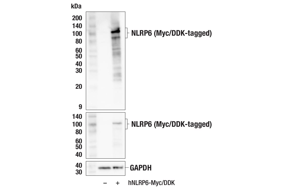 Western Blotting Image 2: NLRP6 (E2S8A) Rabbit Monoclonal Antibody
