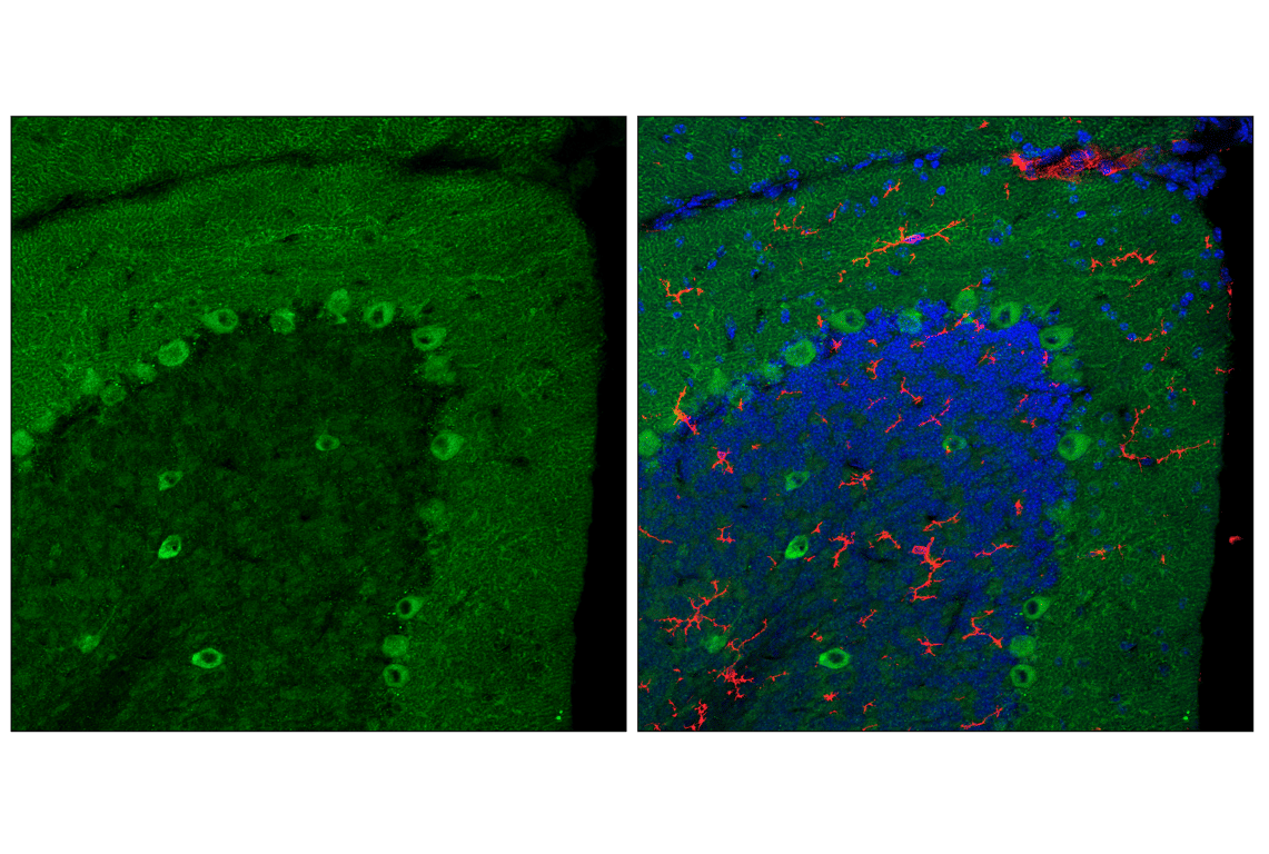 Immunofluorescence Image 2: VAPB (E7R3Z) Rabbit Monoclonal Antibody