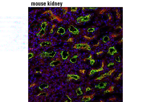 Mab 様 MRP4/ABCC4 (D2Q2O) Rabbit mAb | Cell Signaling Technology