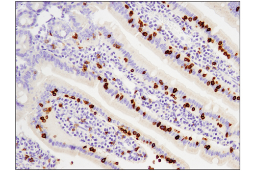 Immunohistochemistry Image 1: CD3 epsilon (D4V8L) Rabbit Monoclonal Antibody (BSA and Azide Free)