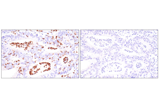 Immunohistochemistry Image 7: CEACAM6 (E7S7Y) Rabbit Monoclonal Antibody