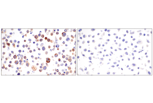 Immunohistochemistry Image 9: CD62P/P-Selectin (E8Q1W) Rabbit Monoclonal Antibody (BSA and Azide Free)