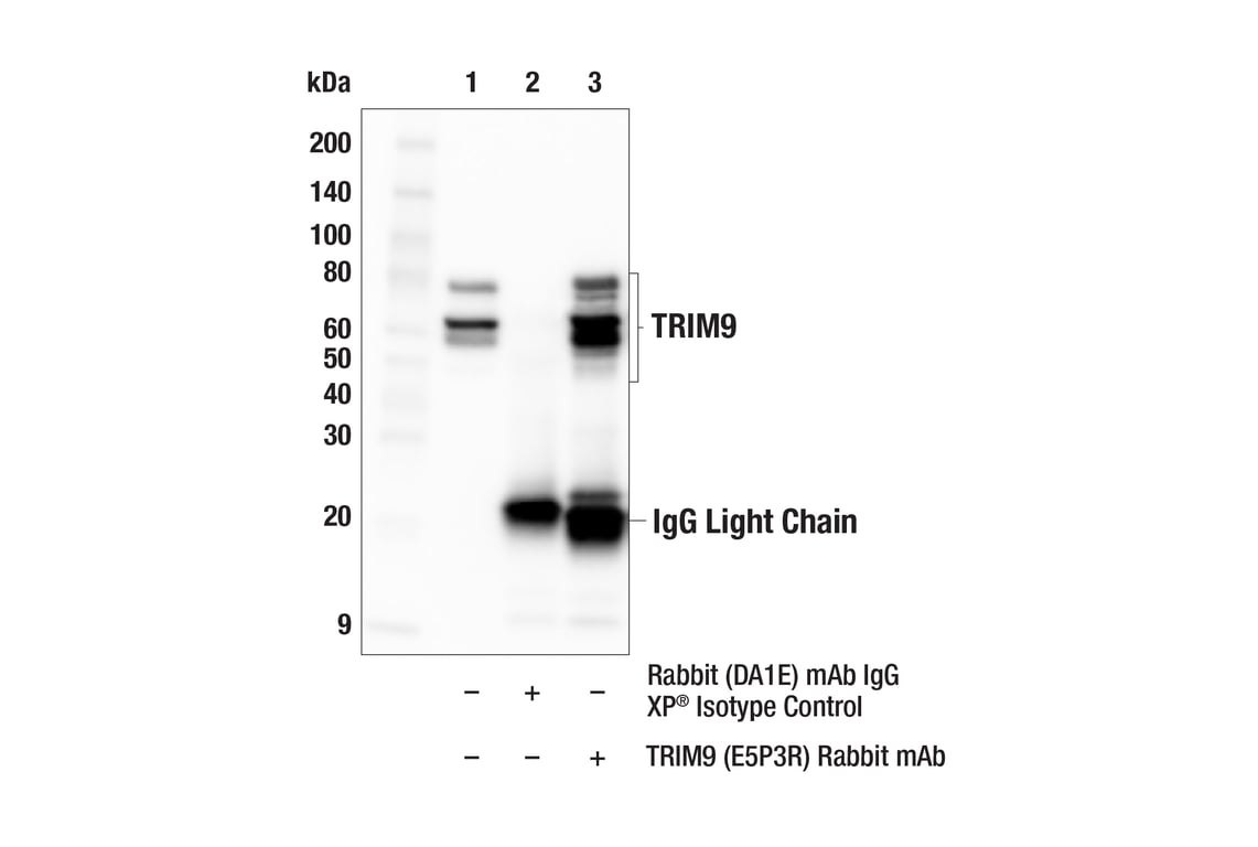 Immunoprecipitation Image 1: TRIM9 (E5P3R) Rabbit Monoclonal Antibody