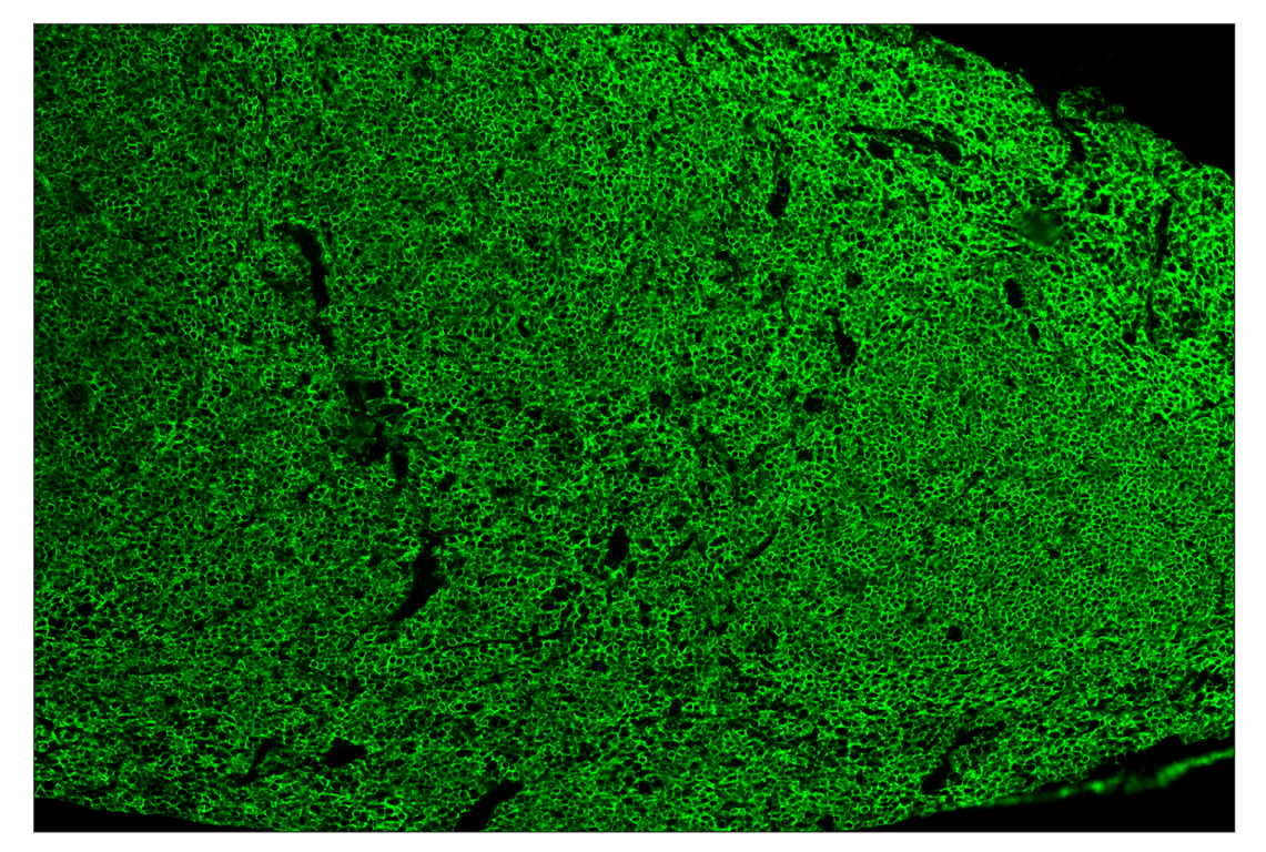 Immunohistochemistry Image 2: CD45 (D3F8Q) & CO-0046-750 SignalStar<sup>™</sup> Oligo-Antibody Pair