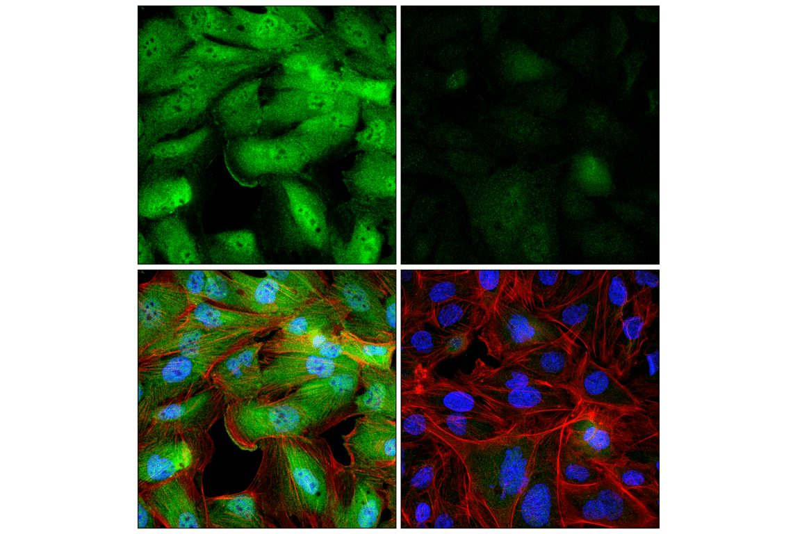 Immunofluorescence Image 1: UBE3C (F2S2J) Rabbit Monoclonal Antibody