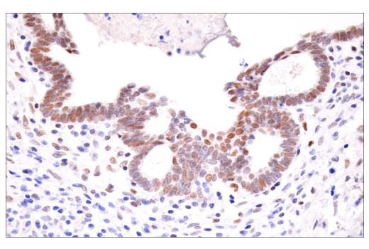 Immunohistochemistry Image 2: HIF-1 alpha (E1V6A) Rabbit Monoclonal Antibody (BSA and Azide Free)