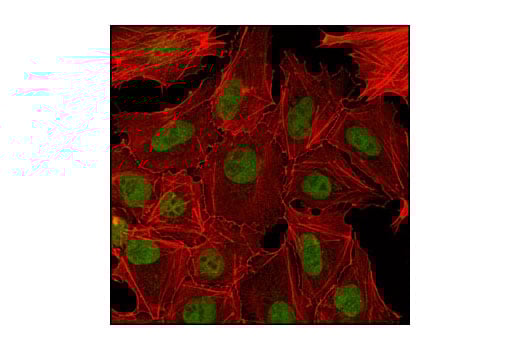 Immunofluorescence Image 1: PHF20 (D96F6) Rabbit Monoclonal Antibody