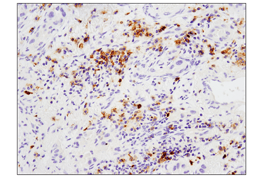Immunohistochemistry Image 1: GITR (D9I9D) Rabbit Monoclonal Antibody