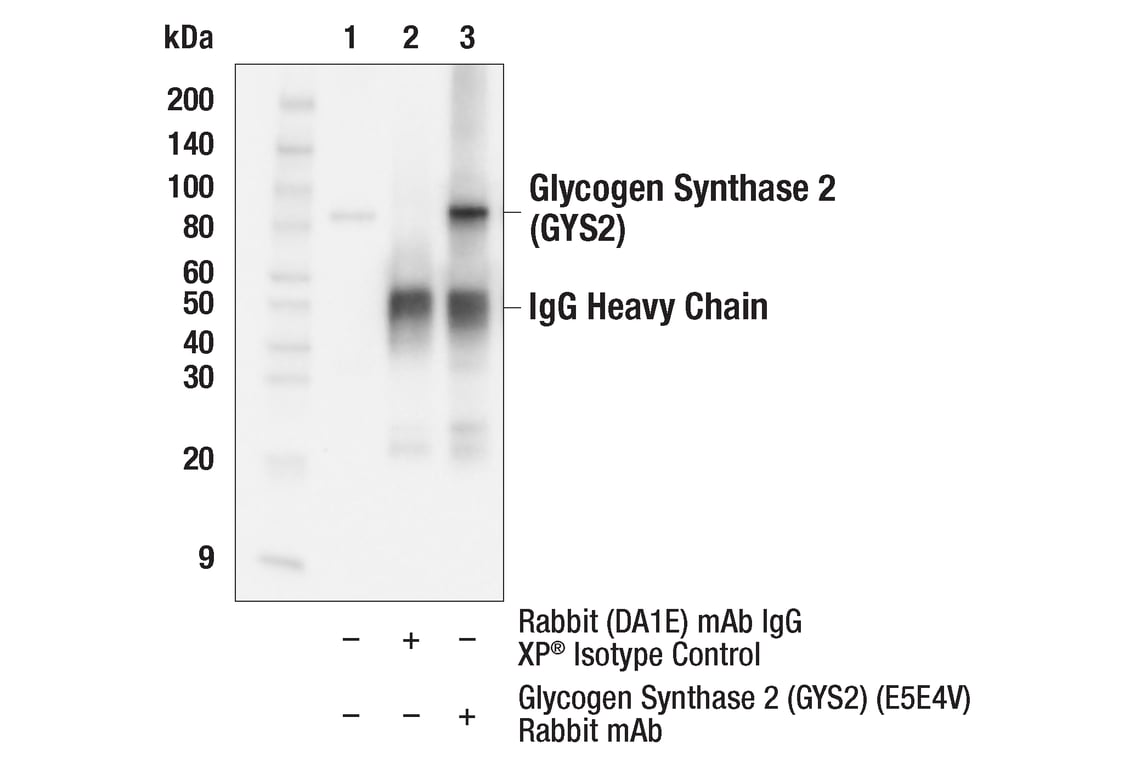 Immunoprecipitation Image 1: Glycogen Synthase 2 (GYS2) (E5E4V) Rabbit Monoclonal Antibody