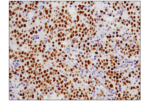 Immunohistochemistry Image 4: ESET (D4M8R) XP<sup>®</sup> Rabbit mAb