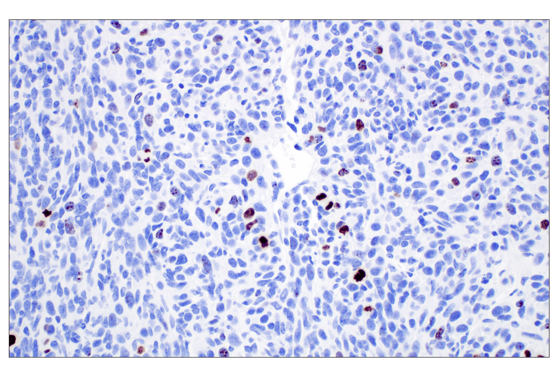 Immunohistochemistry Image 5: Phospho-Histone H3 (Ser10) (D7N8E) Rabbit Monoclonal Antibody