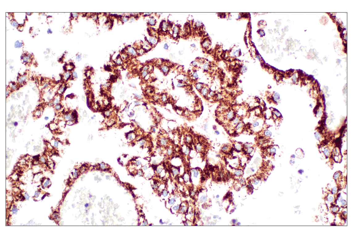 undefined Image 23: Organelle Localization IF Antibody Sampler Kit