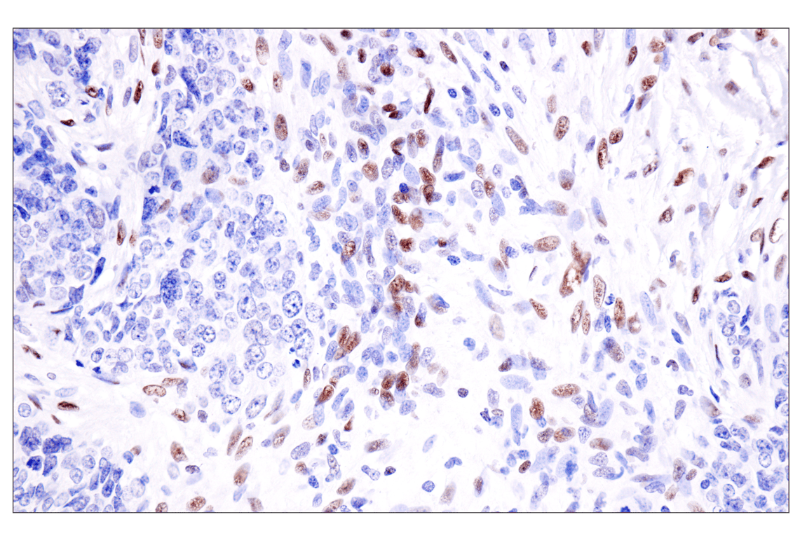 Immunohistochemistry Image 3: ADAR2 (F6U8S) Rabbit Monoclonal Antibody