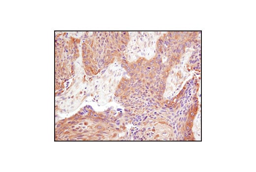 Immunohistochemistry Image 2: PKM2 (D78A4) XP<sup>®</sup> Rabbit mAb (BSA and Azide Free)