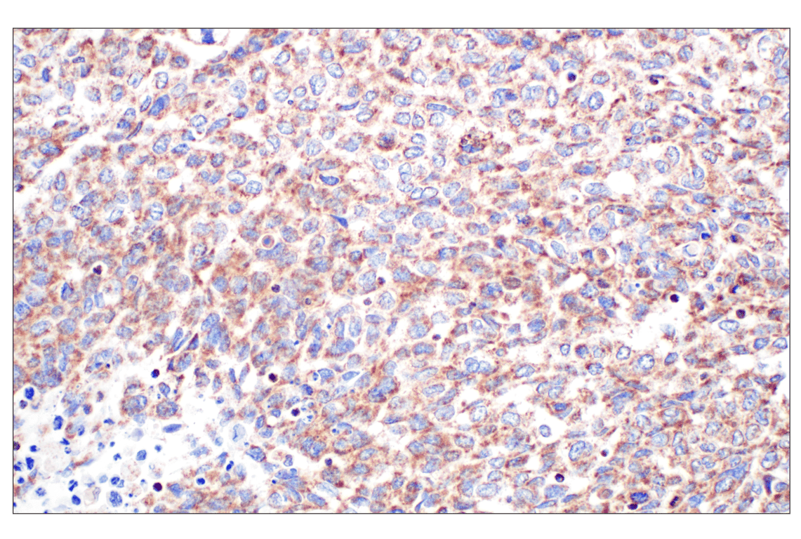 Immunohistochemistry Image 2: GCDH (F2P2M) Rabbit Monoclonal Antibody