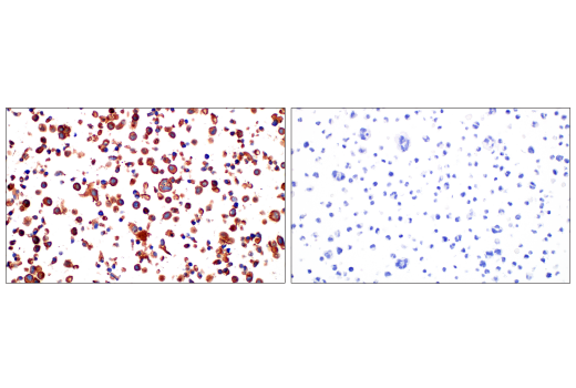 Immunohistochemistry Image 10: Src (36D10) Rabbit Monoclonal Antibody (BSA and Azide Free)