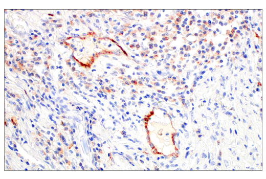 Immunohistochemistry Image 6: LAMP3/CD208 (E6E5U) Rabbit Monoclonal Antibody