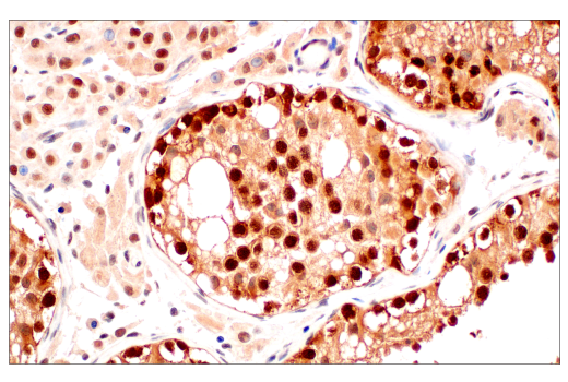 Immunohistochemistry Image 8: CRBN (D8H3S) Rabbit Monoclonal Antibody (BSA and Azide Free)