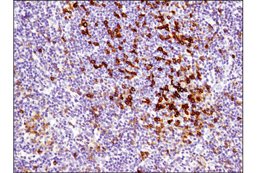 Immunohistochemistry Image 2: PD-1 (Intracellular Domain) (D4W2J) Rabbit Monoclonal Antibody