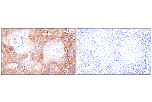 Immunohistochemistry Image 5: CD109 (E4I2V) Rabbit Monoclonal Antibody