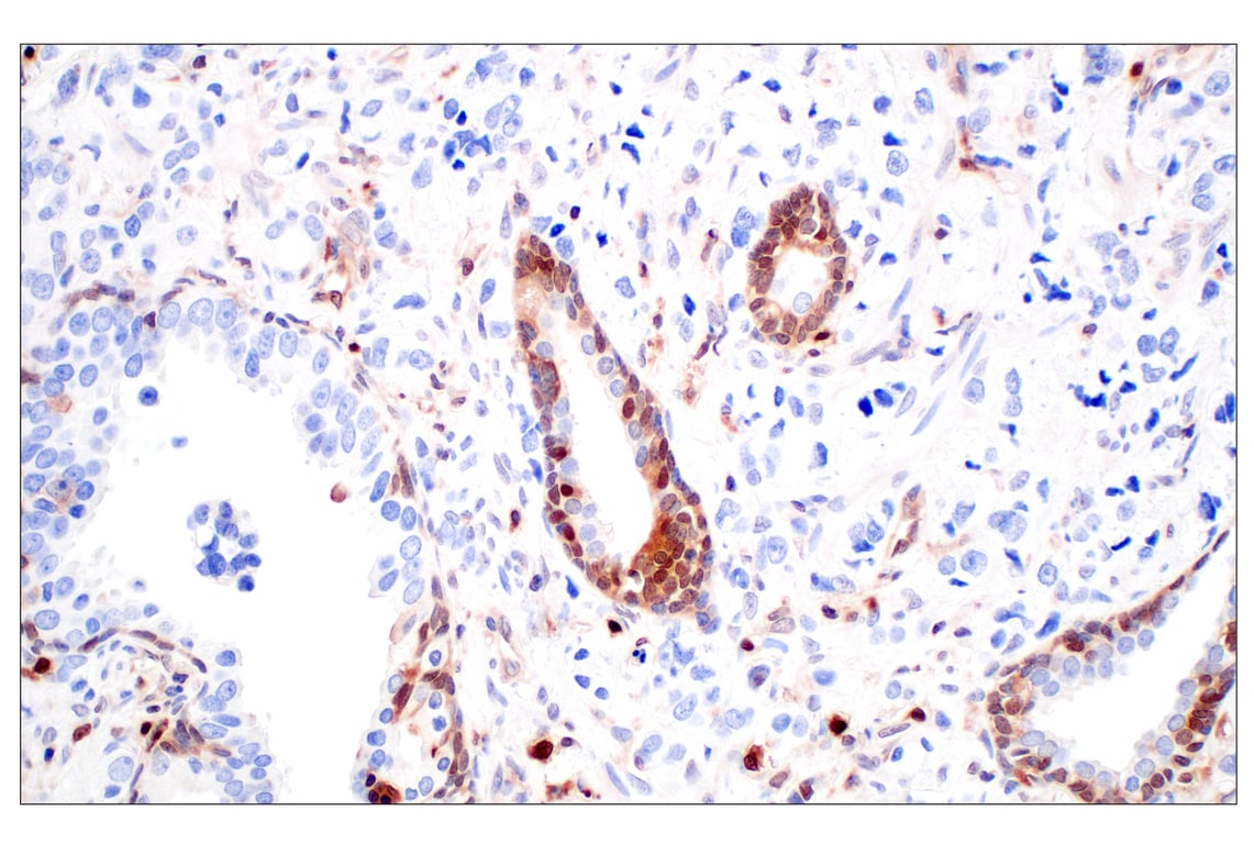 Immunohistochemistry Image 3: SerpinB1 (E4W7B) Rabbit Monoclonal Antibody (BSA and Azide Free)