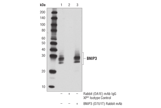 undefined Image 19: Mitophagy Antibody Sampler Kit