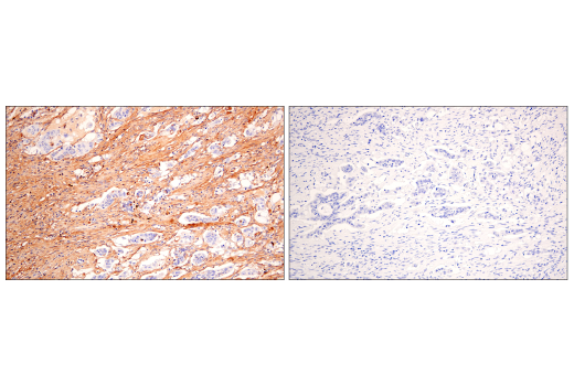 Immunohistochemistry Image 2: Fibronectin/FN1 (E5H6X) Rabbit Monoclonal Antibody (BSA and Azide Free)