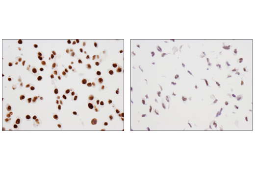 Immunohistochemistry Image 1: TRIM33 (D7U4F) Rabbit Monoclonal Antibody