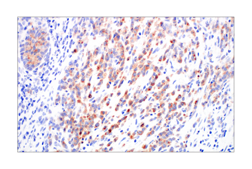 Immunohistochemistry Image 3: ACE2 (E9G3S) Mouse mAb