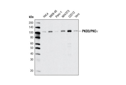 Western Blotting Image 1: PKD3/PKCν (D57E6) Rabbit mAb