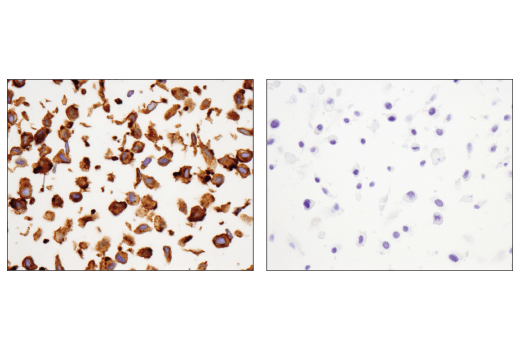 Immunohistochemistry Image 3: NCAM-L1 (D5D3K) Rabbit Monoclonal Antibody