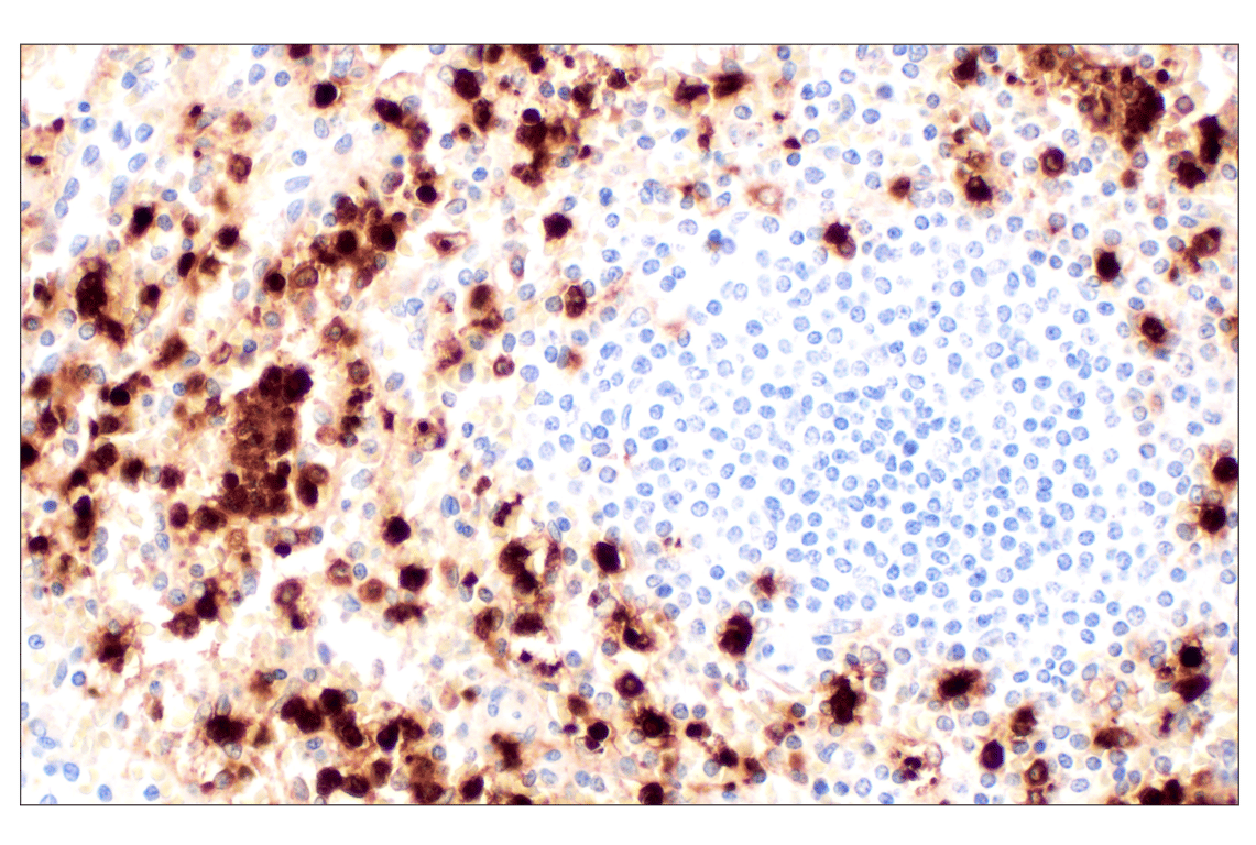 Immunohistochemistry Image 6: Neutrophil Elastase (F4H3X) Rabbit Monoclonal Antibody (BSA and Azide Free)