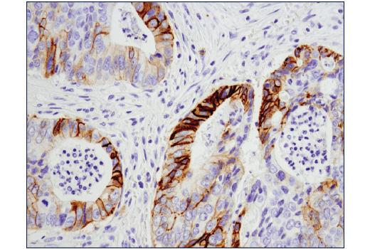 Immunohistochemistry Image 3: NCAM-L1 (D5D3K) Rabbit Monoclonal Antibody (BSA and Azide Free)