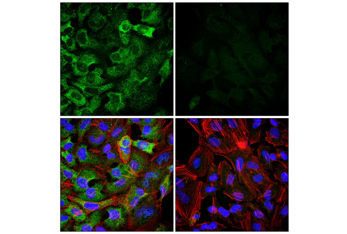 Immunofluorescence Image 1: eIF3B (F1E6A) Rabbit Monoclonal Antibody