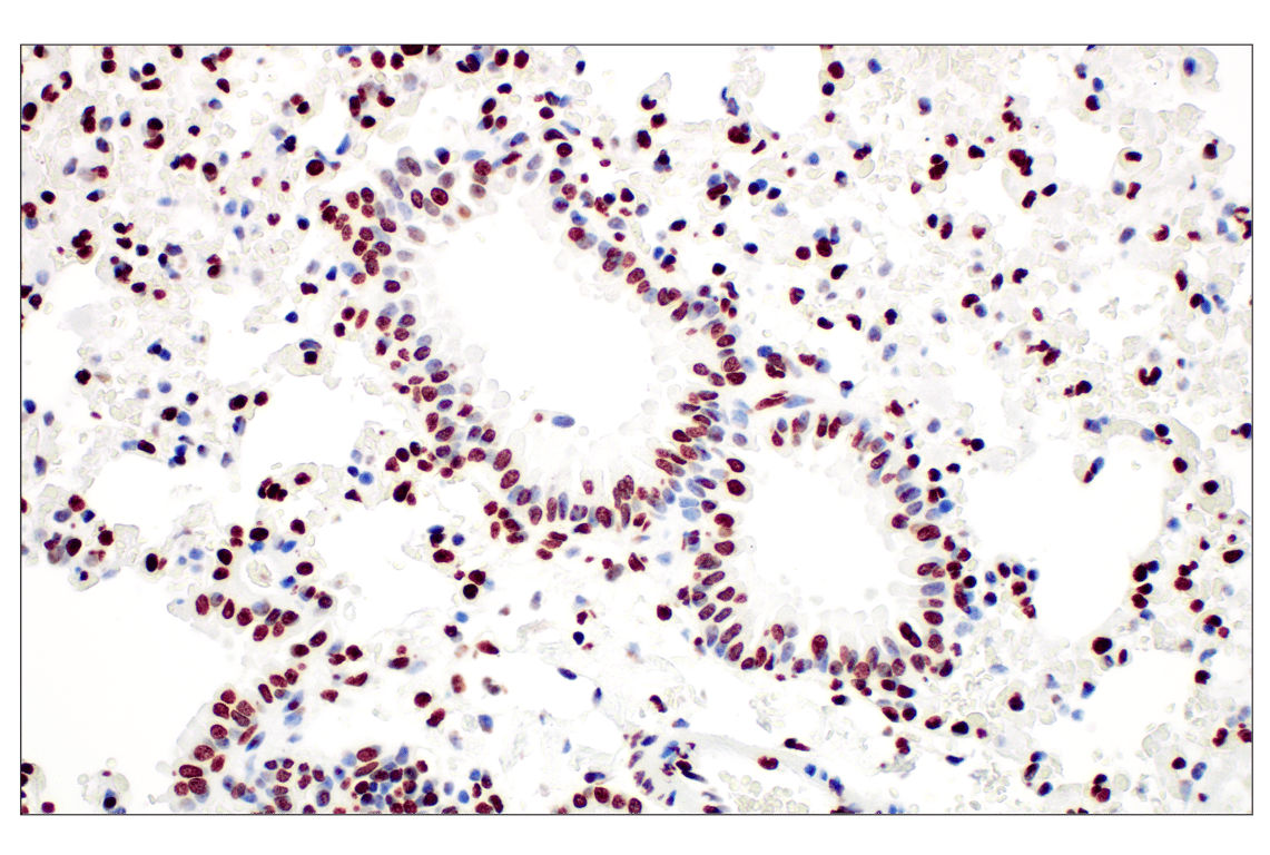 Immunohistochemistry Image 3: Tri-Methyl-Histone H3 (Lys27) (C36B11) Rabbit Monoclonal Antibody