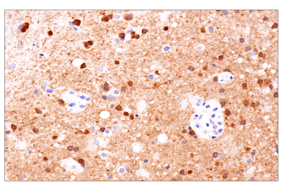 Immunohistochemistry Image 10: PPP1R14A/CPI-17 (F1I6X) Rabbit Monoclonal Antibody