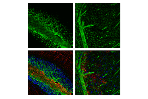 Immunofluorescence Image 1: PLP1 (E9V1N) Rabbit Monoclonal Antibody