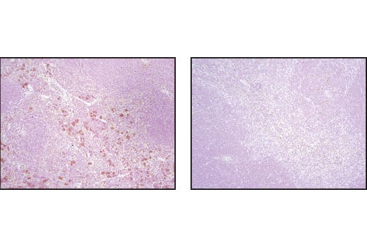 undefined Image 22: 4E-BP Antibody Sampler Kit