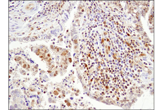 Immunohistochemistry Image 1: Stat5 (D3N2B) Rabbit Monoclonal Antibody