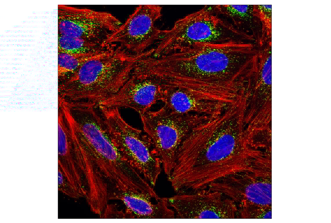 undefined Image 29: Organelle Localization IF Antibody Sampler Kit