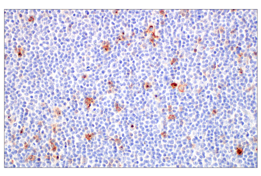 Immunohistochemistry Image 7: CD70 (E3Q1A) Rabbit Monoclonal Antibody (BSA and Azide Free)