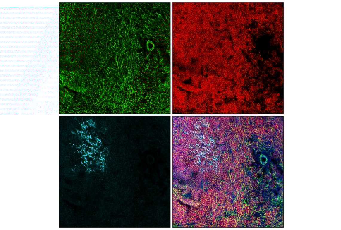 Immunofluorescence Image 2: Filamin A (E8P8M) Rabbit Monoclonal Antibody
