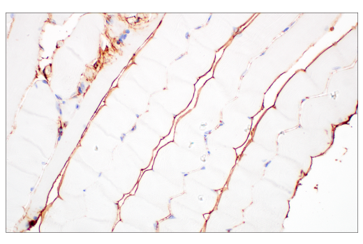 Immunohistochemistry Image 7: EphA2 (D4A2) Rabbit Monoclonal Antibody