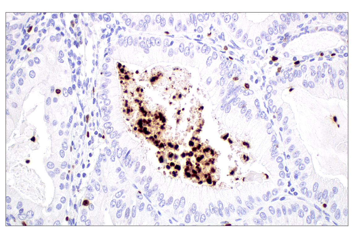 Immunohistochemistry Image 4: MNDA (3C1) Rat Monoclonal Antibody