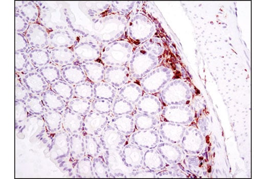 Immunohistochemistry Image 2: LCP1 (D1C3) Rabbit Monoclonal Antibody