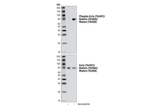 Western Blotting Image 2: Phospho-Ezrin (Thr567)/Radixin (Thr564)/Moesin (Thr558) (48G2) Rabbit Monoclonal Antibody (BSA and Azide Free)